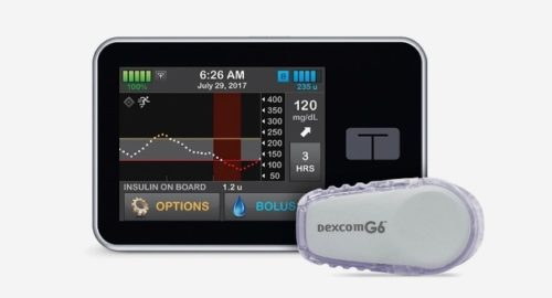 Artificial Pancreas System Outperforms Current Technology In New Study