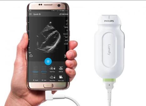 Handheld Ultrasound Aids First Mobile ECMO Unit in a Pre-hospital Setting Handheld Ultrasound Aids First Mobile ECMO Unit in a Pre-hospital Setting