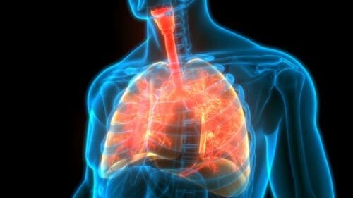 FDA grants first clearance to AI program for diagnosing idiopathic pulmonary fibrosis