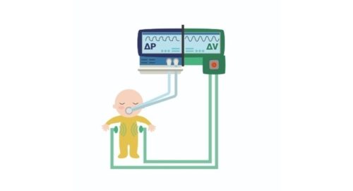 A Gentler Technique For Artificial Respiration A Gentler Technique For Artificial Respiration