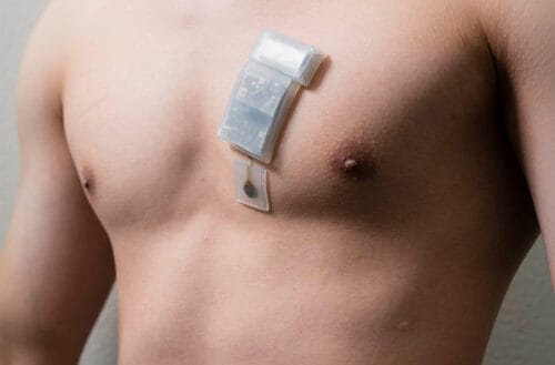 Wearable Ultrasound for Deep Tissue Monitoring