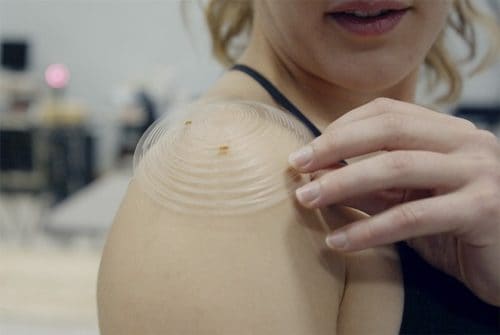 Printed Kirigami Sensor Hugs Shoulder to Measure Recovery Printed Kirigami Sensor Hugs Shoulder to Measure Recovery