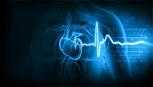 FDA OKs Abbott’s 6-year insertable cardiac monitor