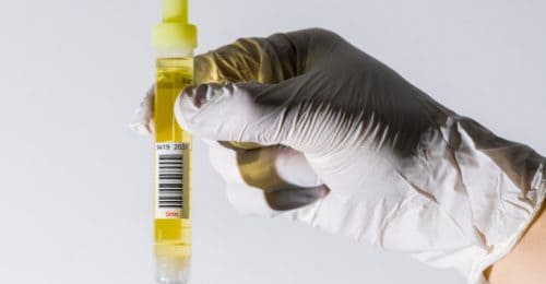 Predicine Launches Liquid Biopsy Assay in Europe