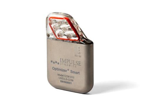 Optimizer System for Cardiac Contractility Modulation: Interview with Dr. Ishu Rao, Medical Director of Impulse Dynamics Optimizer System for Cardiac Contractility Modulation: Interview with Dr. Ishu Rao, Medical Director of Impulse Dynamics