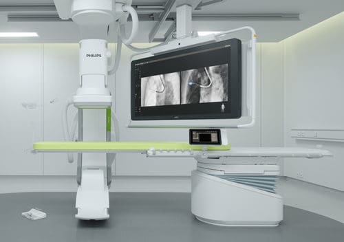 Philips Azurion Lung Edition for High Precision Bronchoscopy Procedures | Medgadget