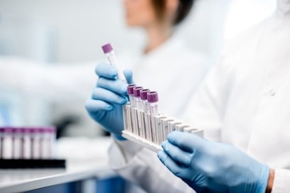 FDA ranks the performance of 58 molecular coronavirus tests from major developers