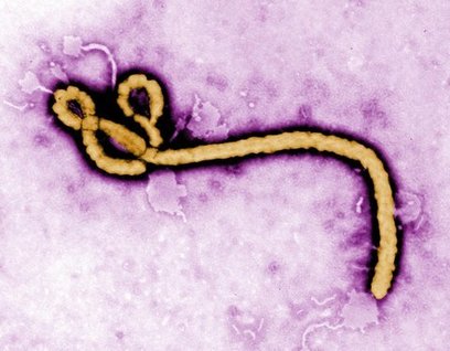 30-minute Ebola virus diagnostic