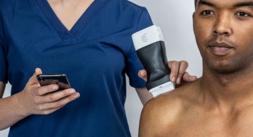Smaller, More Powerful, More Affordable Pocket Ultrasound Scanners