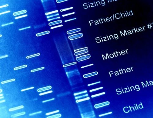 Genetic screening algorithm can estimate a person’s risk of developing chronic kidney disease