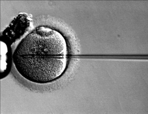 New nanosensing technique enhances quality control for gene therapy vectors