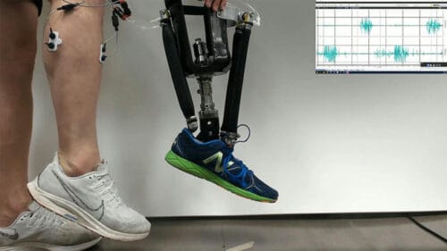 Robotic Ankle Helps with Postural Control in Amputees