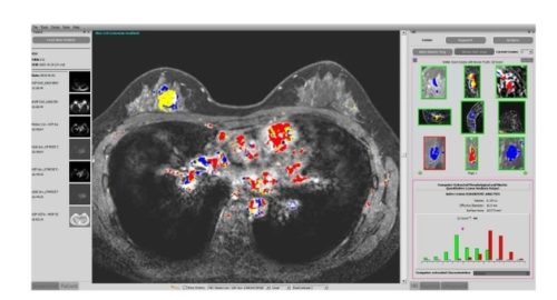 FDA-Cleared Artificial Intelligence Breast Cancer Diagnosis System Launched By Paragon Biosciences FDA-Cleared Artificial Intelligence Breast Cancer Diagnosis System Launched By Paragon Biosciences