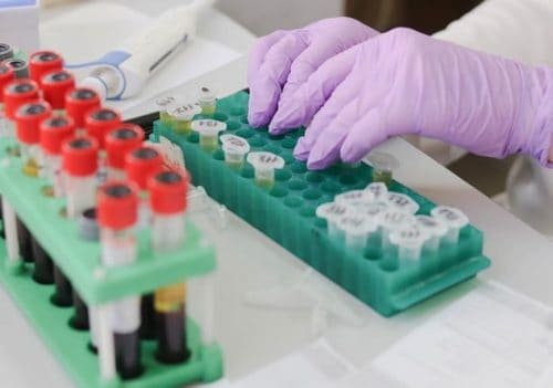 Hologic wraps up acquisition of molecular diagnostic provider Mobidiag Hologic wraps up acquisition of molecular diagnostic provider Mobidiag