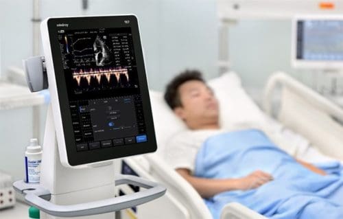 Mindray’s New High End Point of Care Ultrasound