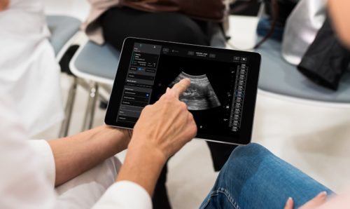 Exo Raises $220M to Commercialize Handheld, Point-of-Care Ultrasound Device