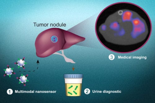 A noninvasive test to detect cancer cells and pinpoint their location A noninvasive test to detect cancer cells and pinpoint their location