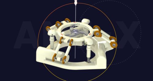 Clinical trials for AI robotic device for minimally invasive surgeries eyed in South Korea Clinical trials for AI robotic device for minimally invasive surgeries eyed in South Korea