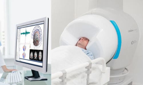Magnetoencephalography Machine to Map Brain Activity FDA Approved