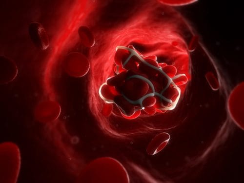 Study Uncovers How Some COVID-19 Vaccines Cause Blood Clots