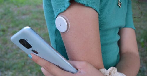 A Turning Point for Continuous Glucose Monitors