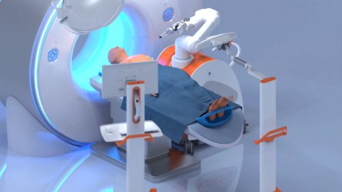 FDA clears Quantum Surgical’s liver-cancer-focused ablation robot