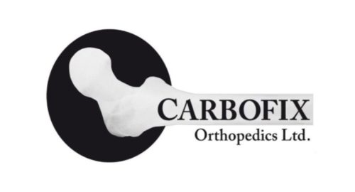 CarboFix Extends Its CarboClear® Carbon Fiber Spinal Product Line With Its FDA Cleared Vertebral Body Replacement (VBR) System