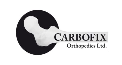 CarboFix Extends Its CarboClear® Carbon Fiber Spinal Product Line With Its FDA Cleared Vertebral Body Replacement (VBR) System CarboFix Extends Its CarboClear® Carbon Fiber Spinal Product Line With Its FDA Cleared Vertebral Body Replacement (VBR) System