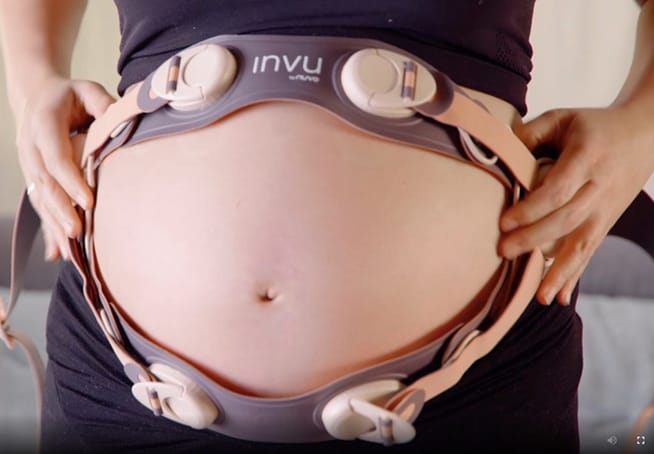 Remote Pregnancy Monitoring System