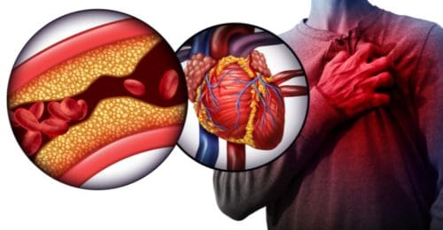 Electroducer Touts Pilot Study Results for Heart Device