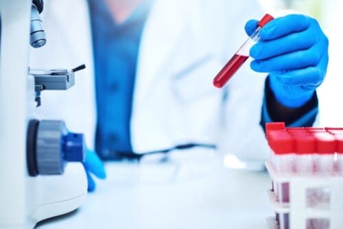 Clinical lab industry sues to block FDA’s new oversight of lab-developed tests