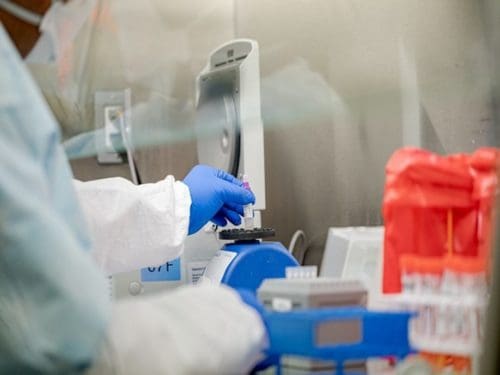 BD Announces an IVD Immune Assay Application That Can Aid in Patient Management Decisions in COVID-19 | Health BD Announces an IVD Immune Assay Application That Can Aid in Patient Management Decisions in COVID-19 | Health
