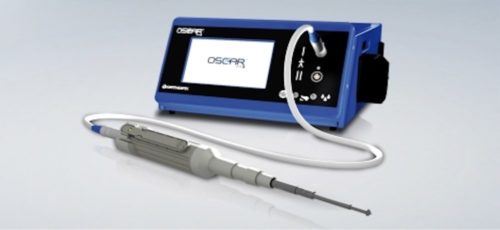 New arthroplasty revision system launched in Europe and U.S. New arthroplasty revision system launched in Europe and U.S.