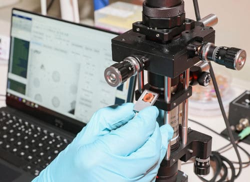 Portable Nanoplasmonic Imager Detects Sepsis Biomarkers