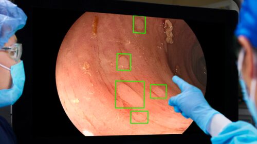 Medtronic doubles down on endoscopy AI with $200M Cosmo deal