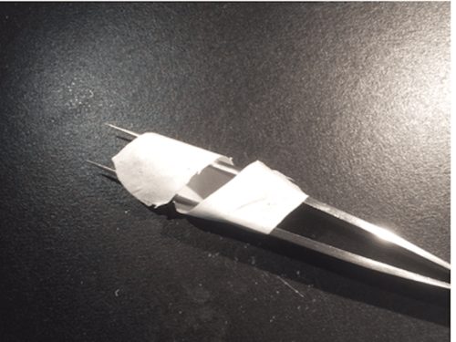 Irish researchers create implantable device to help heal tendon injuries