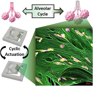 Cell Culture System Mimics Effects of Lung Motion on Cancer Metastases | Medgadget Cell Culture System Mimics Effects of Lung Motion on Cancer Metastases | Medgadget
