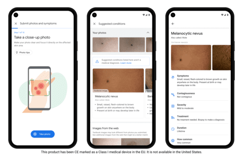 Google debuts AI-powered app to help consumers identify common skin conditions