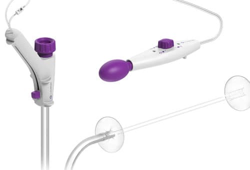 Incisionless appendectomy performed with device from Westport’s Lumendi Incisionless appendectomy performed with device from Westport’s Lumendi